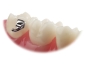 Preview: VIPER™, Bondable buccal tube, Mini (tooth 27), .018", Torque -10°, Offset 0°