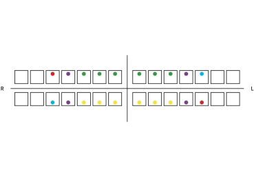 CLB™ Chois Lingual Brackets, Brackets einzeln