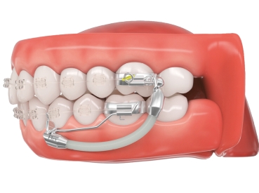 Flex Developer™ 2.0, sliding arch right