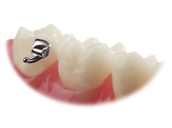 VIPER™, Bondable buccal tube, Mini (tooth 27), .018", Torque -10°, Offset 0°